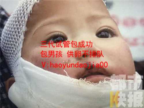 绝经供卵成功率多少_北京供卵试管中介_[怀孕]高危女性需要做哪些检查_体检一