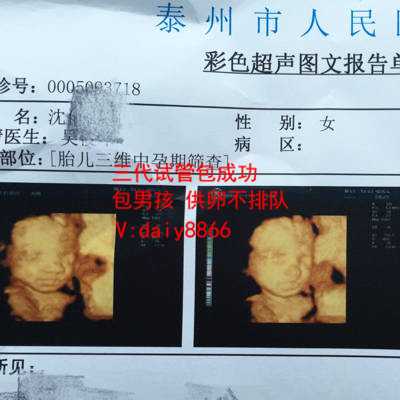北京代怀价格表_泰国试管婴儿：做了试管就不会“生化妊娠”了？